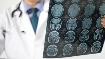 Pandemi beyni yaşlandırdı: Covid olmasanız bile etkilenmiş olabilirsiniz Nottingham Üniversitesi'nin geniş çaplı araştırması, Covid-19 pandemisinin neden olduğu izolasyon